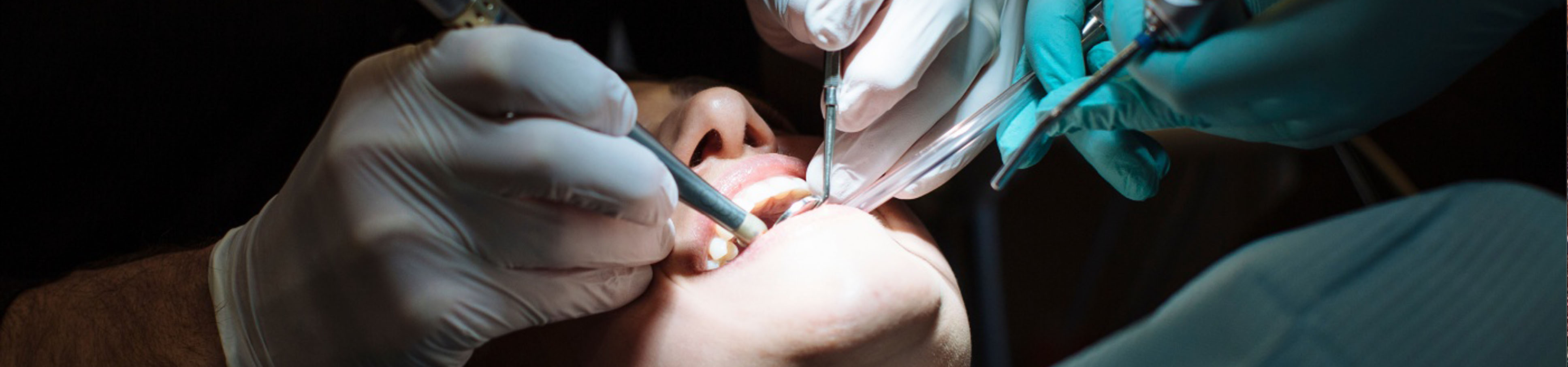 Surgical Extractions & Oral Surgery